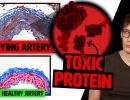 a toxic protein is filling your